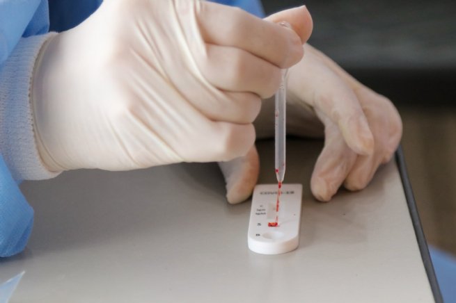 Foto: Prefeitura informa como são realizados os testes para detectar a Covid-19